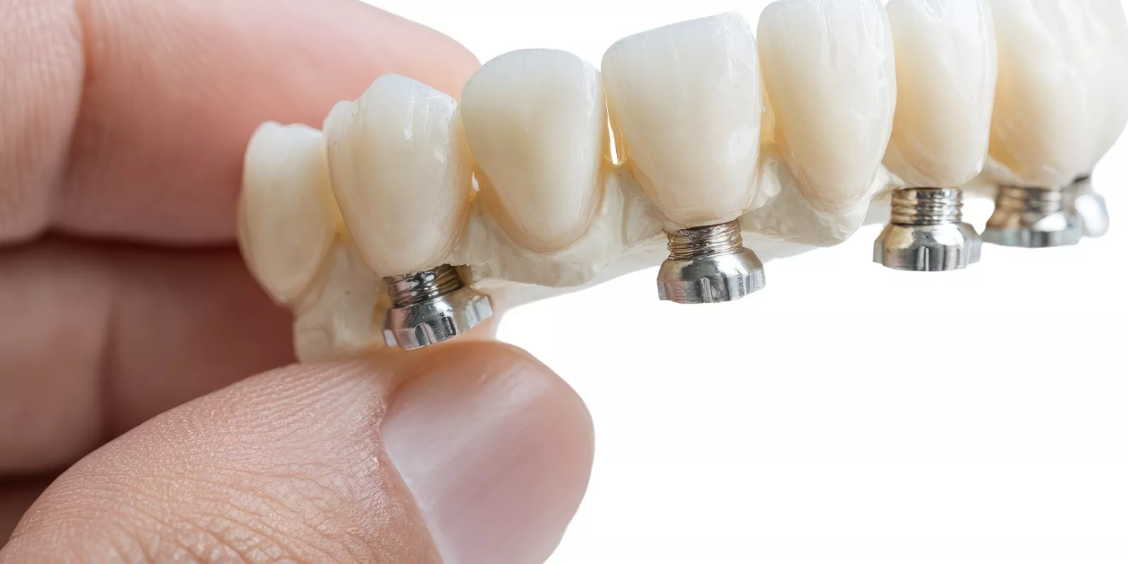 Servicii Protetica Neodent Tecuci