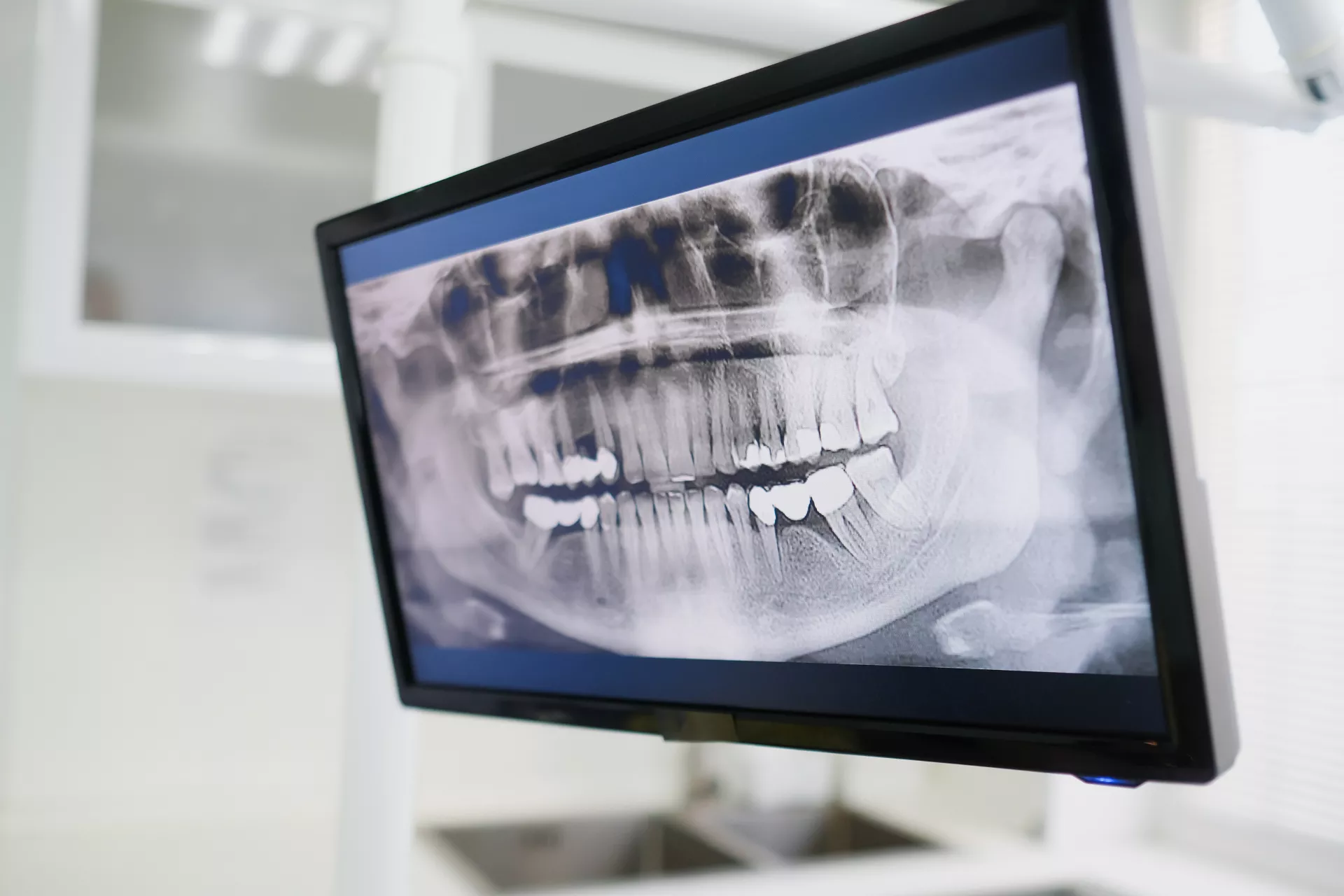 Articol Radiografie Dentara Neodent Tecuci